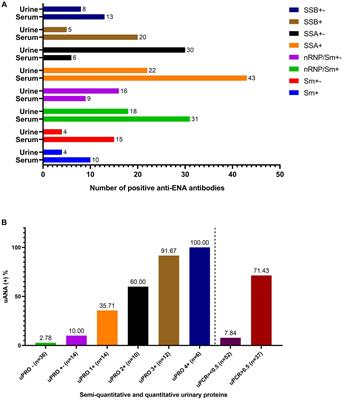 Association of urine autoantibodies with disease activity in systemic lupus erythematosus